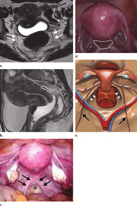 Normal Vulva